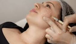 What is Endolift