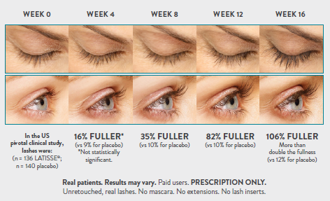 Latisse eyelash treatment in NYC