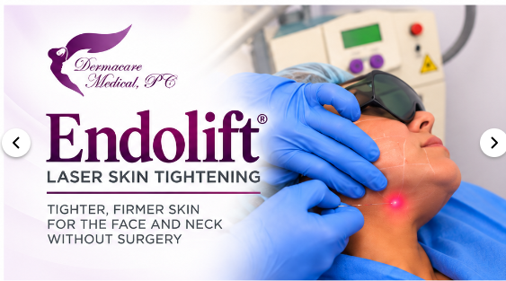 Endolift laser skin tightening at Dermacare Medical